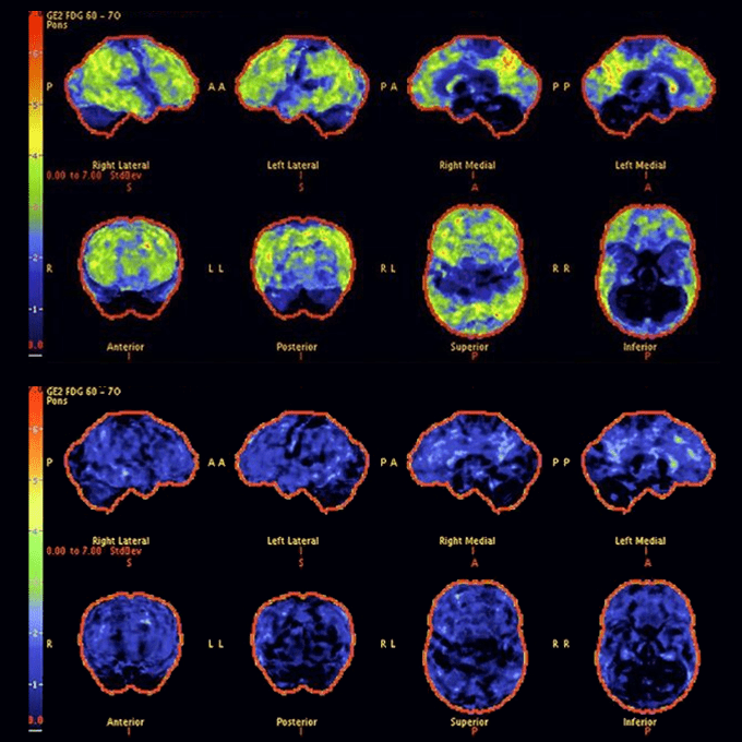 DAFEILA® FreshLoom Cognitive Regeneration Inhaler 15 DAFEILA® FreshLoom Cognitive Regeneration Inhaler