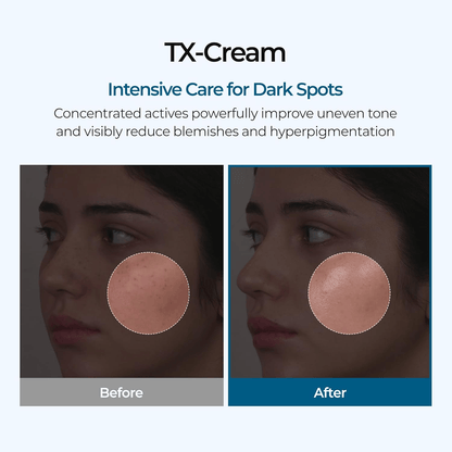 DR.Malexin TX Tranexamic Acid CREAM | Skin freckle Cream, Blemishes, Anti-pigmetation korean skin care | Korean Cosmetics | 1.7 fl oz (50 ml)