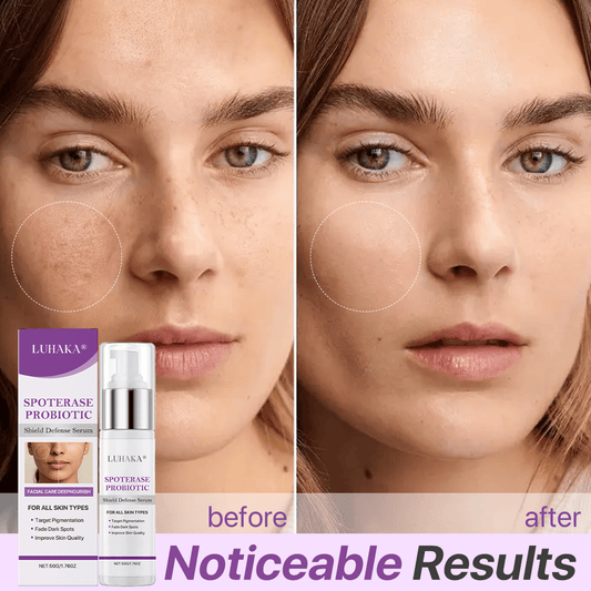 Luhaka® SpotErase Probiotic Shield Defense Serum
