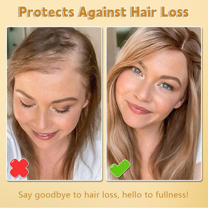 Biancat™ Biotin Hair Growth Essence Spray 🔥Enjoy Special Discount🔥