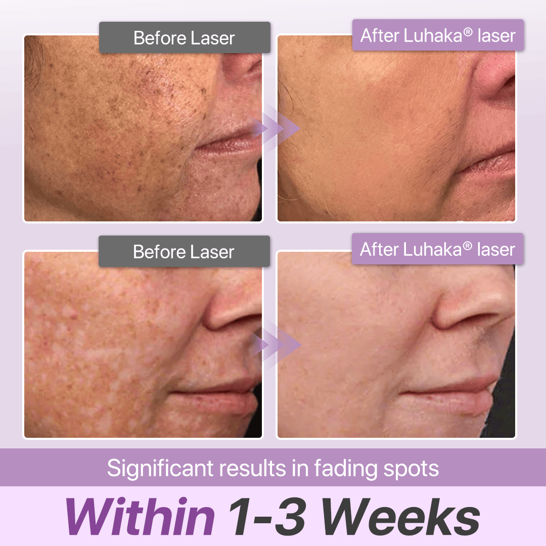 Luhaka® SpotErase Probiotic Shield Defense Serum