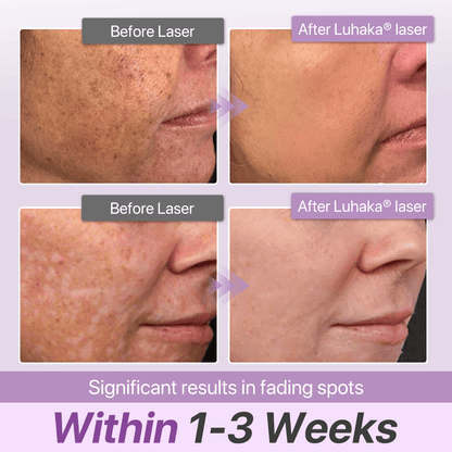 Luhaka® SpotErase Probiotic Shield Defense Serum