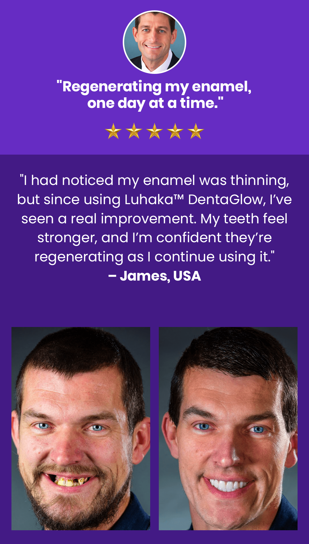 Luhaka™ DentaGlow Tooth & Gum Regeneration Booster 30 3 4623b1ff 5322 4906 a2c2 5733ebf764ee