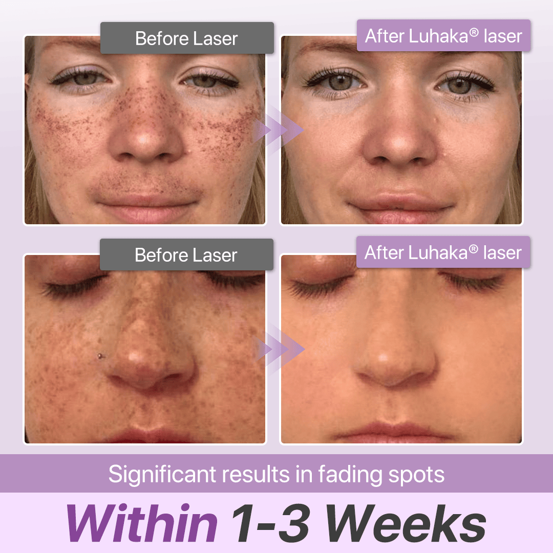 Luhaka® SpotErase Probiotic Shield Defense Serum