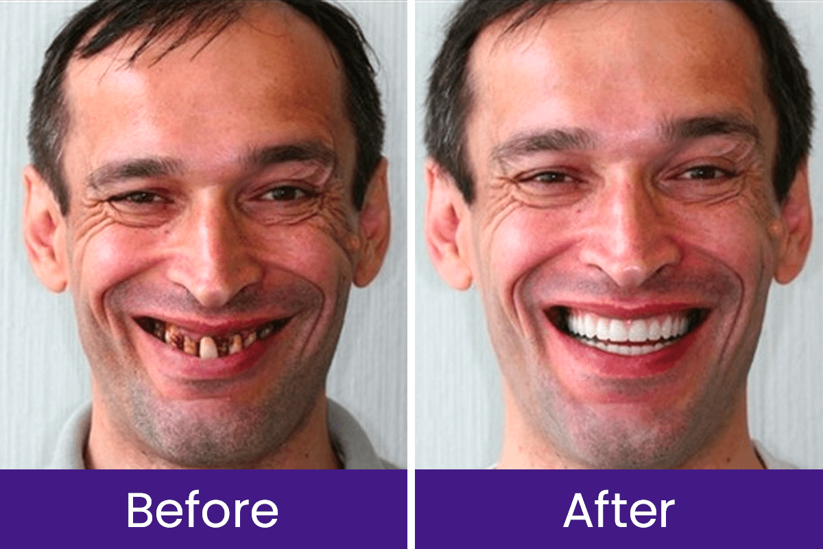 Luhaka™ DentaGlow Tooth & Gum Regeneration Booster 20 3 a6893938 e7b7 40e0 abb3 a41f7cf6c54b