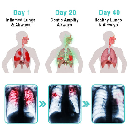 KISSHI™️ BreathePure Respiratory Cleansing Herbal Nasal Device💊