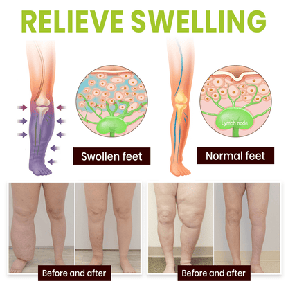 Lyyeto® Professional Leg Circulation Cream