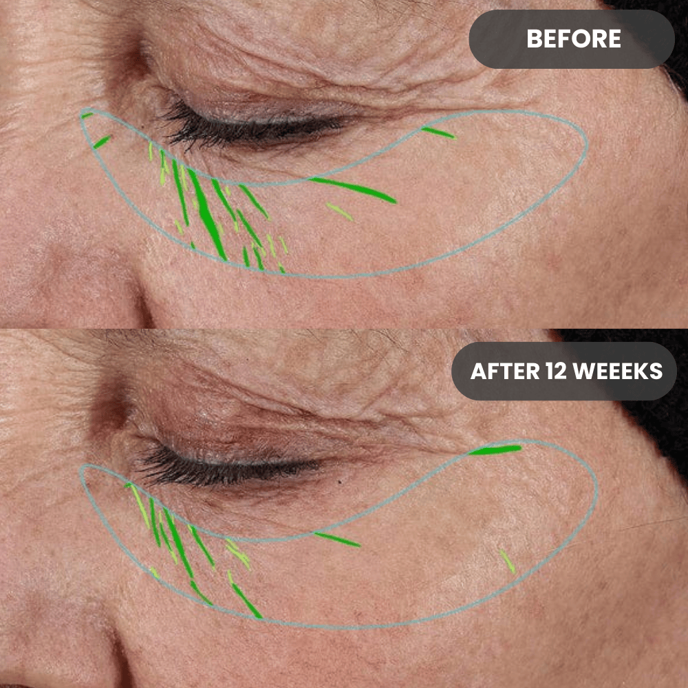 No Needle Growth Factor Serum