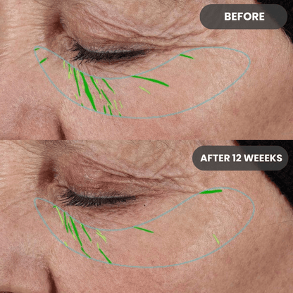 No Needle Growth Factor Serum