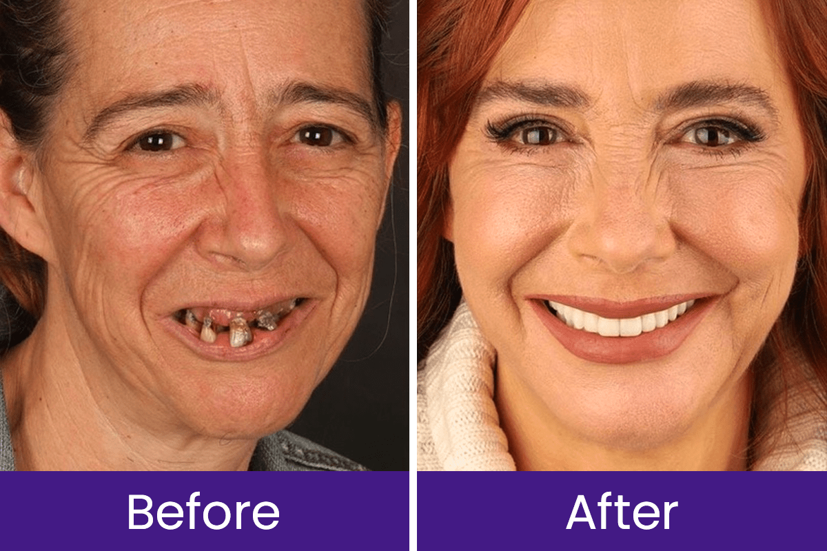 Luhaka™ DentaGlow Tooth & Gum Regeneration Booster 21 4 e4033650 edc4 42b0 905c ff9459854abd