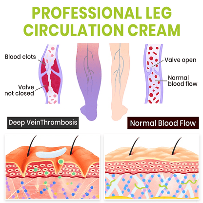 Lyyeto® Professional Leg Circulation Cream