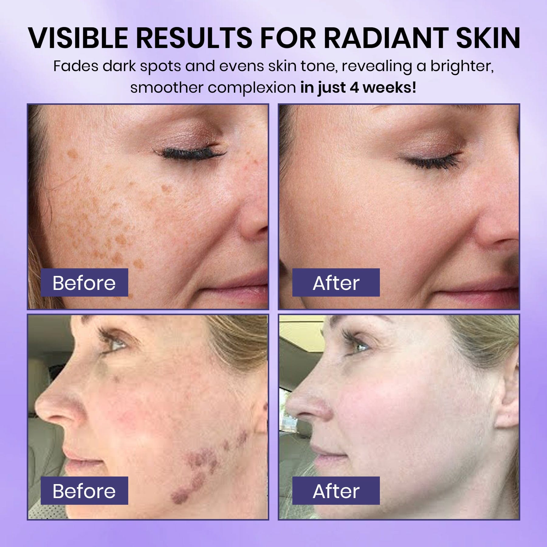 Luhaka® Radiglow  Brightening Dark Spot Gel