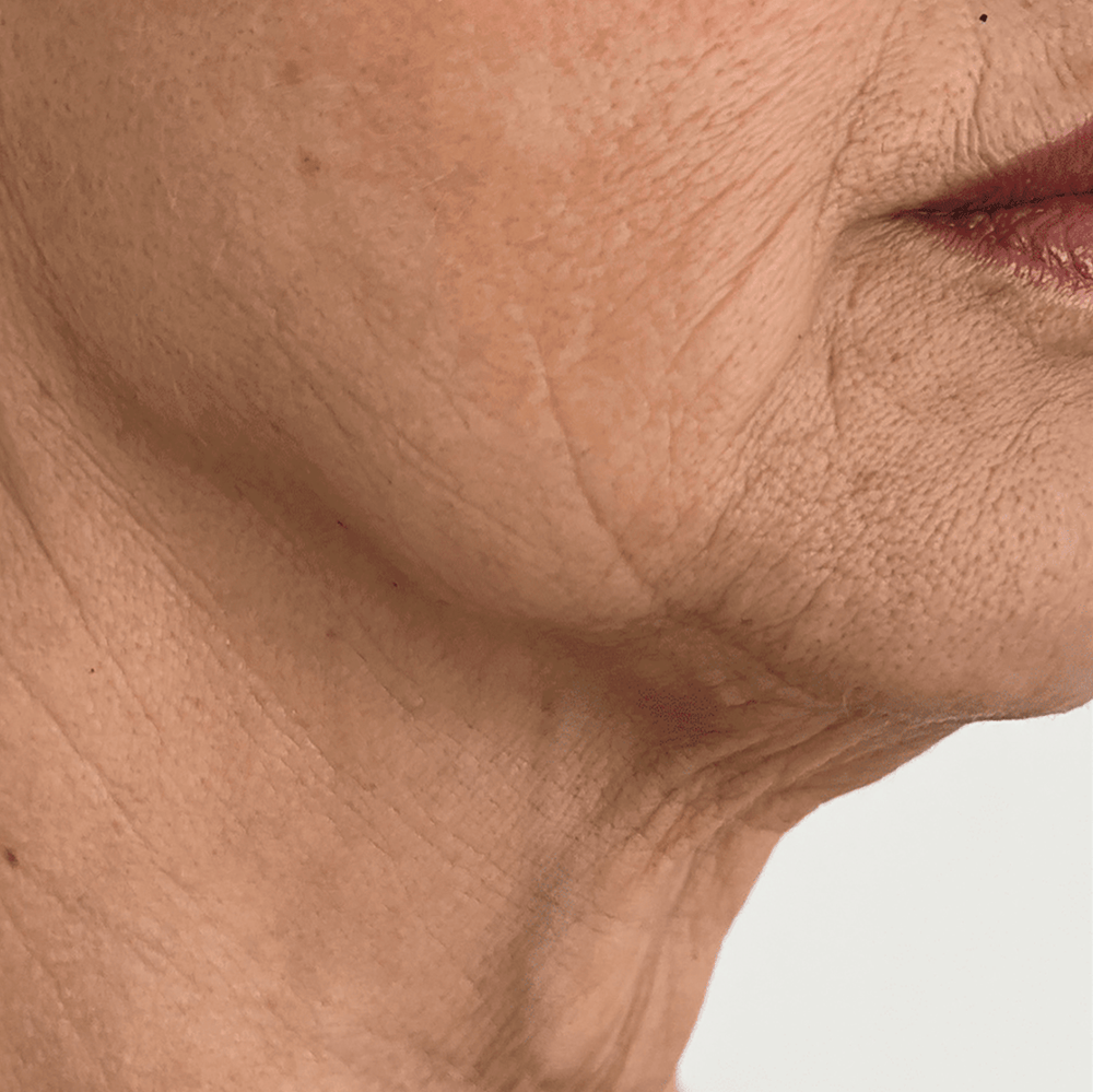 Luhaka® Chanpagme Amazing Lift Cream