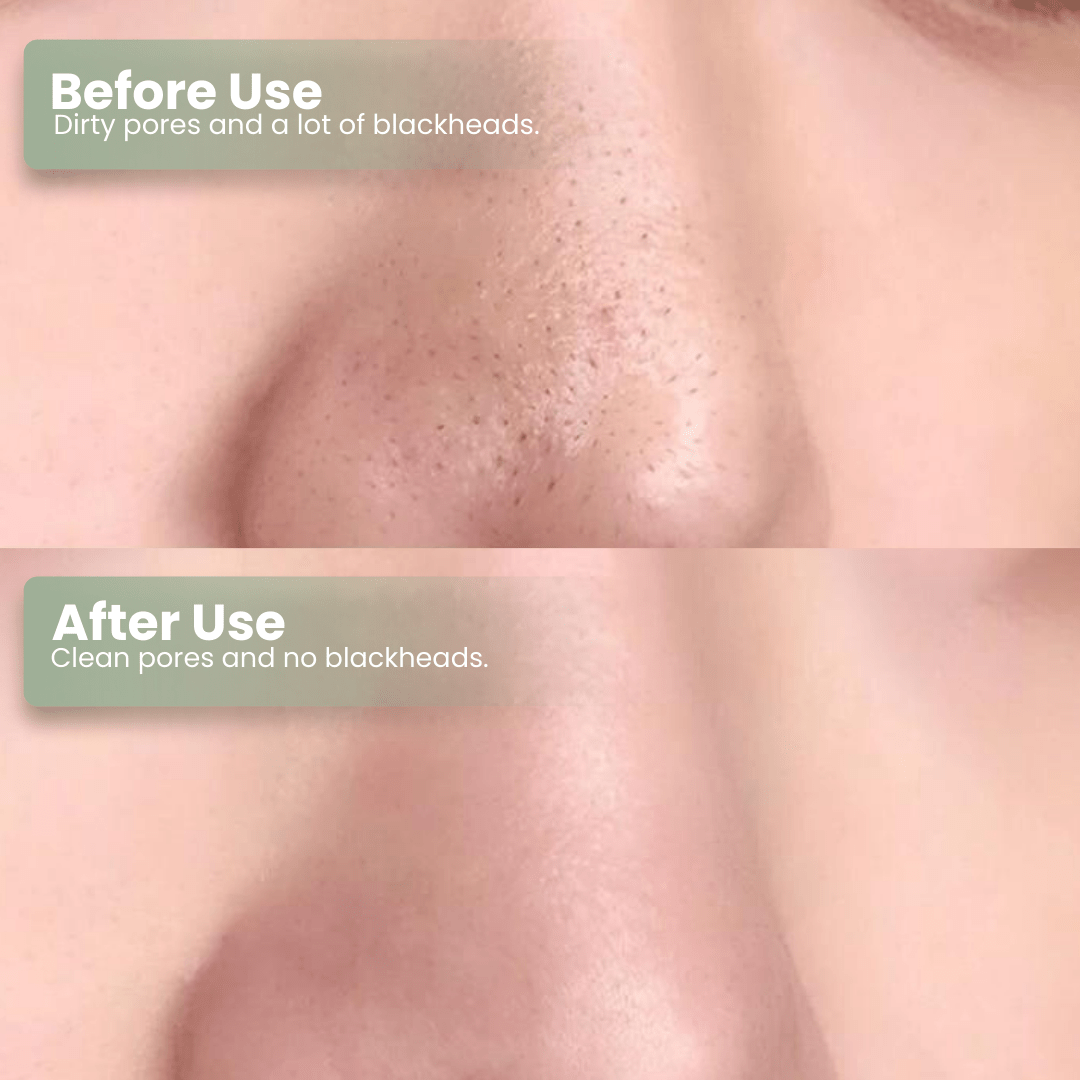 LUHAKA®  Green Tea Deep Cleanse Mask Stick ACE 1