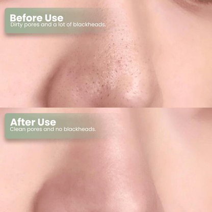 LUHAKA®  Green Tea Deep Cleanse Mask Stick ACE 1