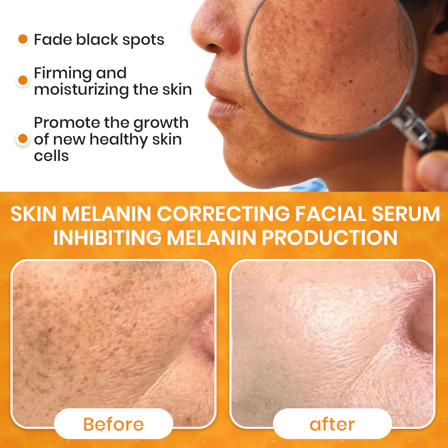 ✨Fast Dark Spot Remover-Luhaka® Melanin Correcting Facial Serum