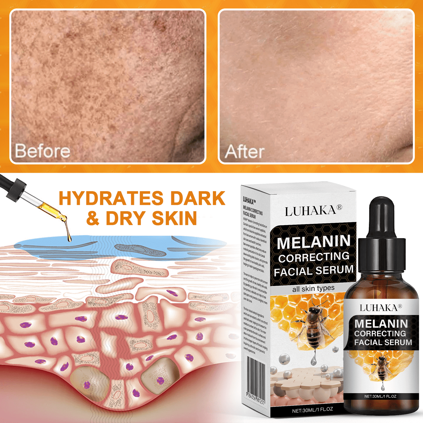 ✨Fast Dark Spot Remover-Luhaka® Melanin Correcting Facial Serum