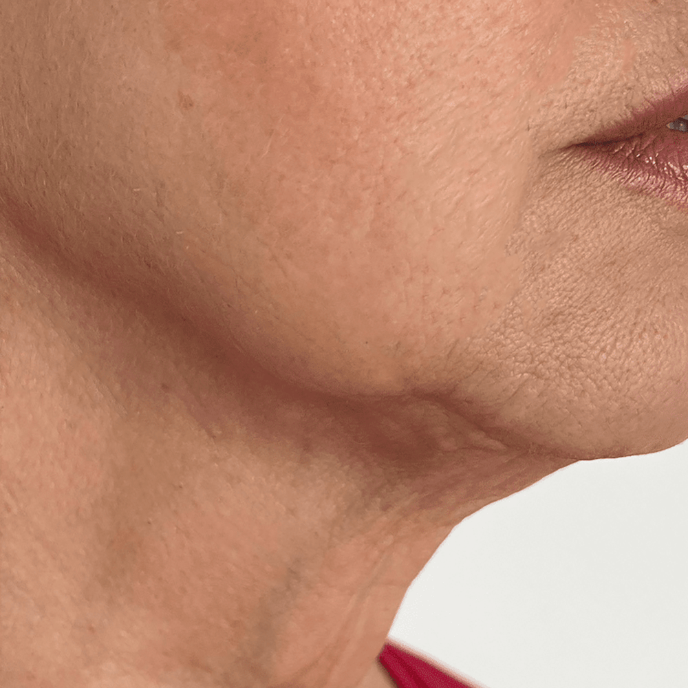 Luhaka® Chanpagme Amazing Lift Cream