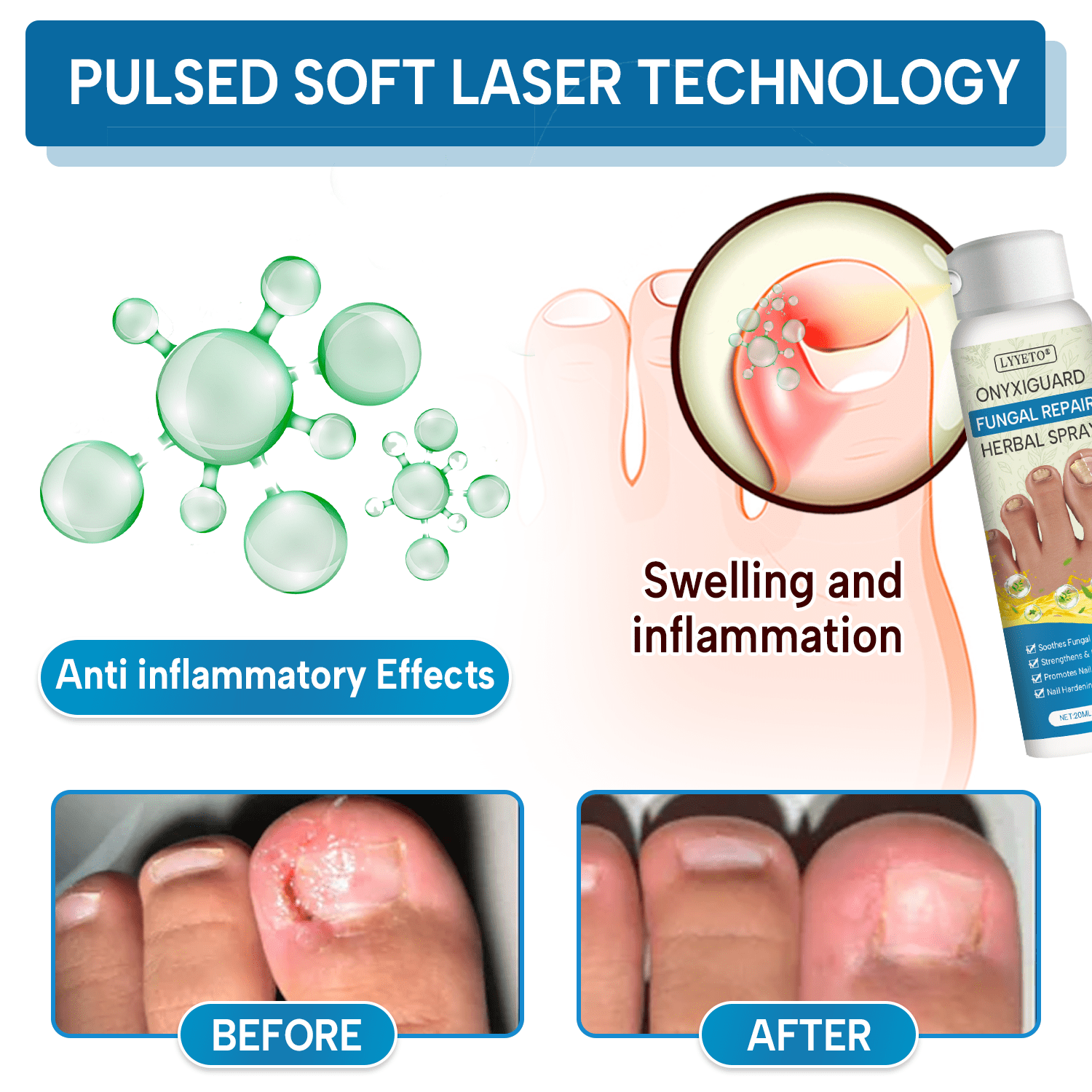 Lyyeto® OnyxiGuard Fungal Repair Herbal Spray