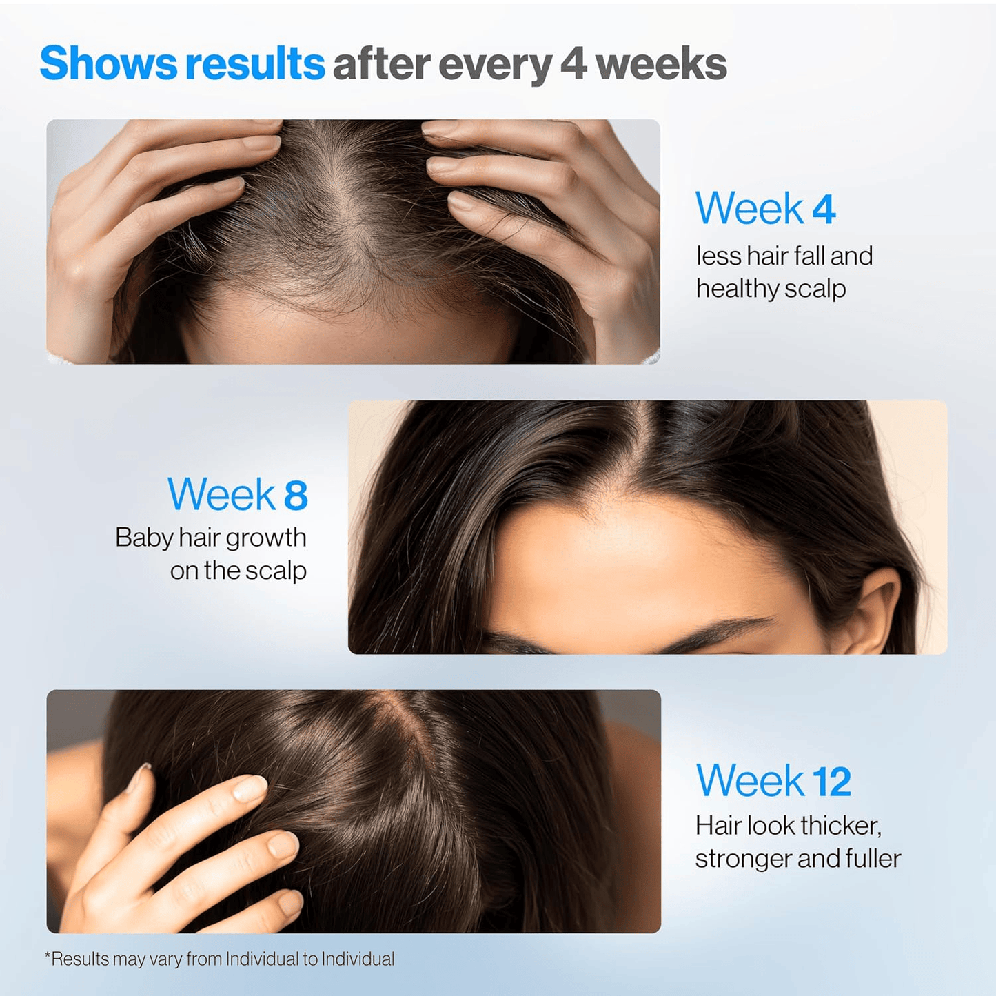 Advanced Hair Growth Serum Roll On (25ml) ACE 1