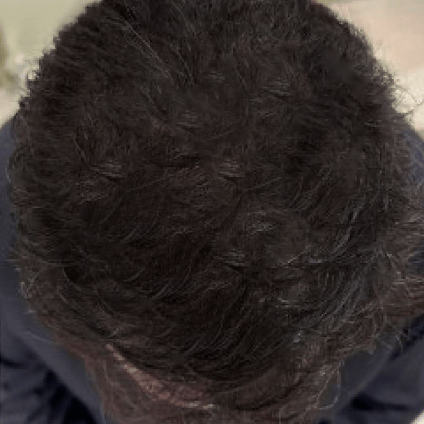 Lyyeto® HairRevix Advanced Hair Restoration Liquid Pearl 27 Lyyeto® HairRevix Advanced Hair Restoration Liquid Pearl