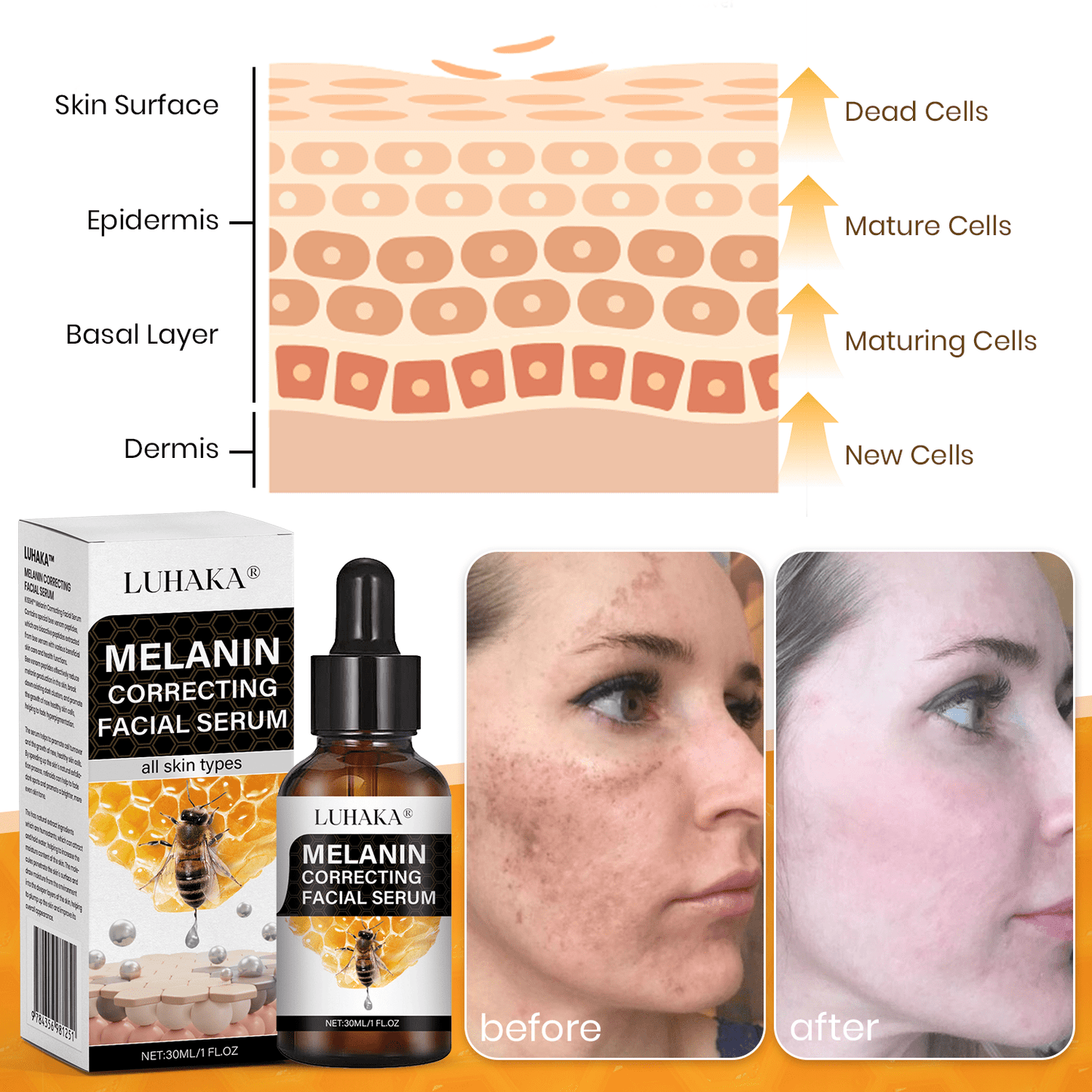 ✨Fast Dark Spot Remover-Luhaka® Melanin Correcting Facial Serum