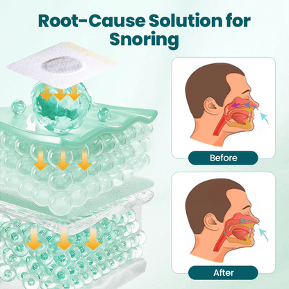 LUHAKA™ SilentBreathe  Anti-Snore Patch