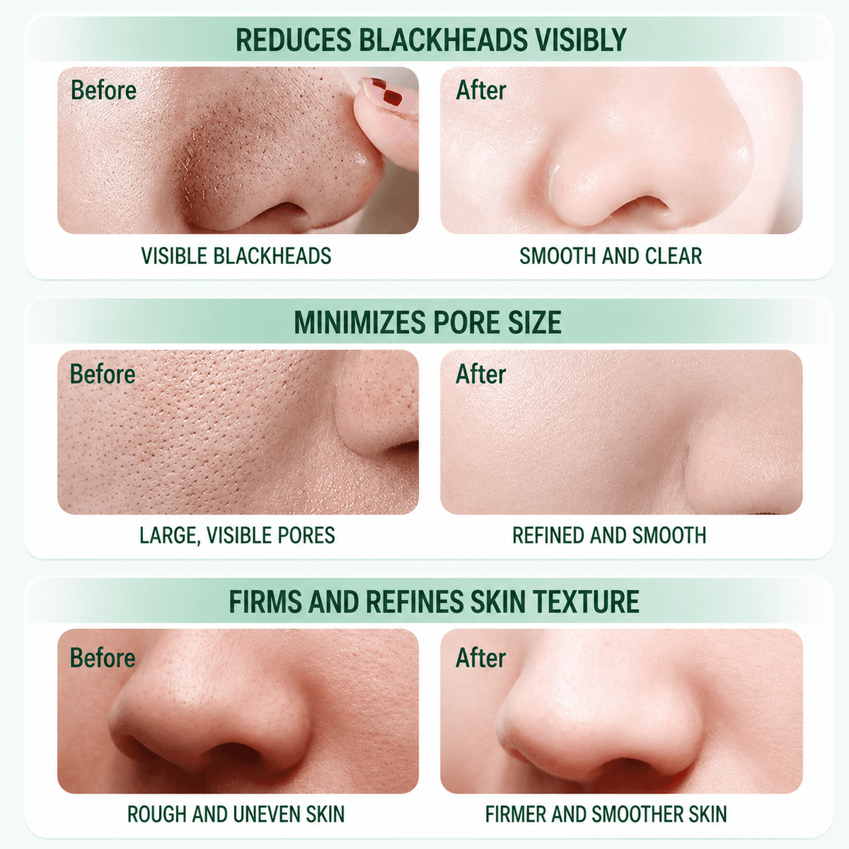 before and after pore care results
