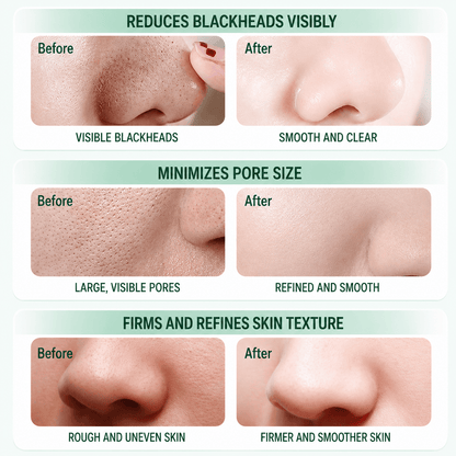 Pore Cleansing Bubble Nose Mask