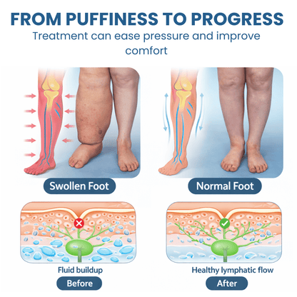 Lyyeto® Swelling Relief Roll-on Cooling Cream