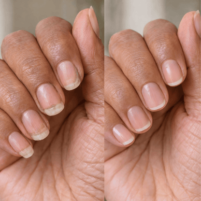 Dual-Function Electric Nail Trimmer & Polisher