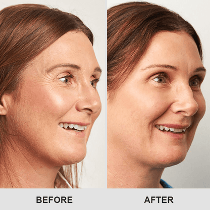 Kisshi™ Retinol Eye Stick ACE