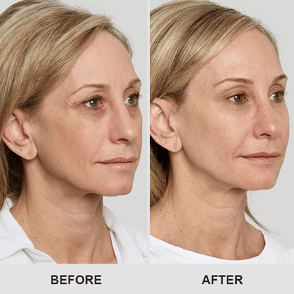 Kisshi™ Retinol Eye Stick ACE