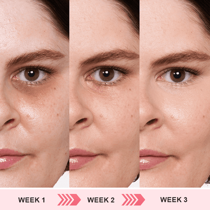 Kisshi™ Retinol Eye Stick ACE