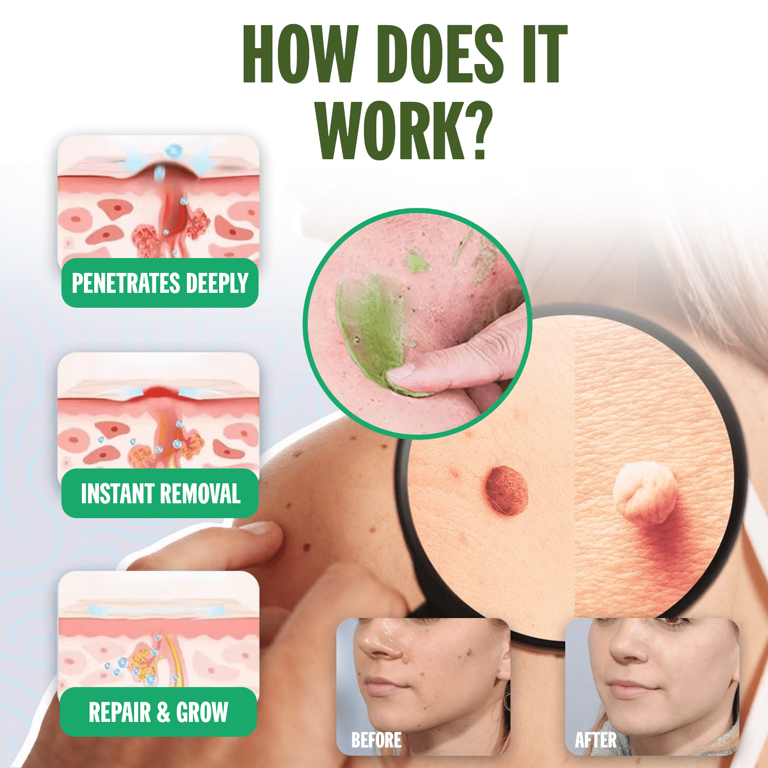 ✅Official Store: Luhaka™ NATURESTORE Instant Mole & Spot Cream