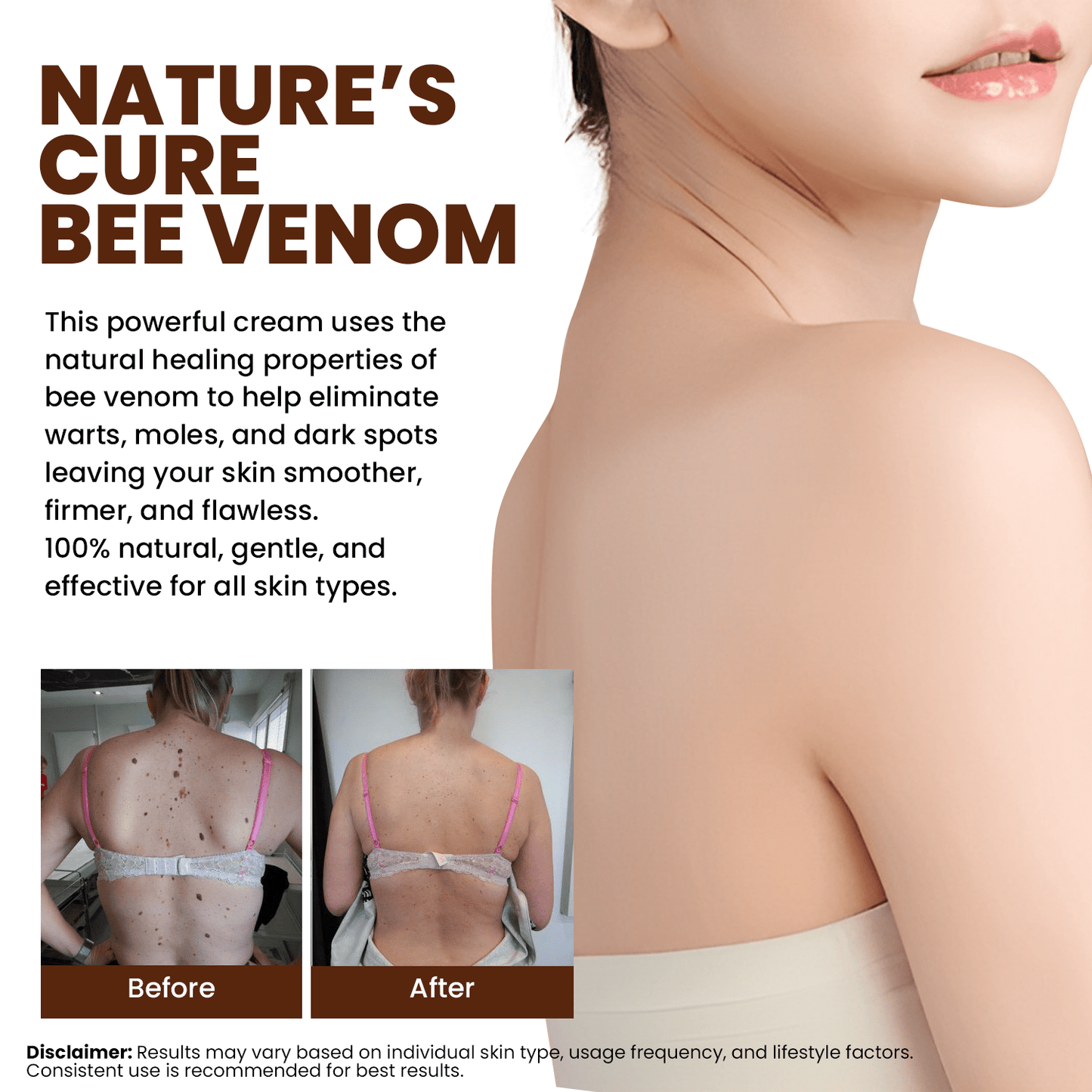Lyyeto® Bee Venom Skin Treatment Cream