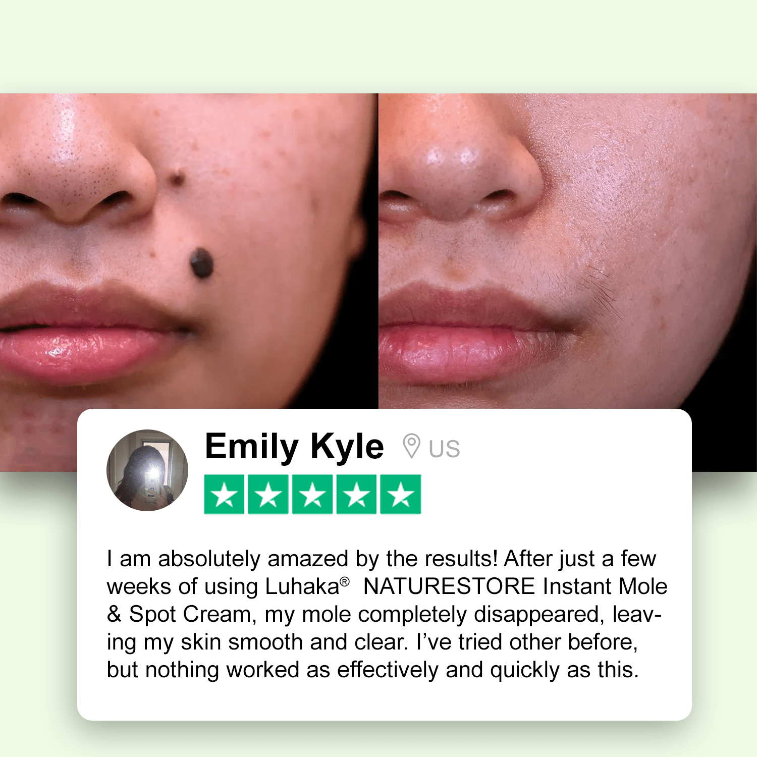 Luhaka® NATURESTORE Instant Mole & Spot Cream_Ultra01