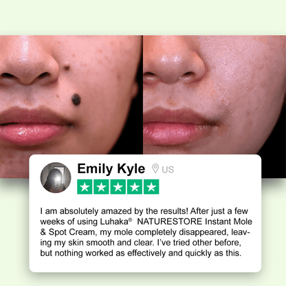 Luhaka® NATURESTORE Instant Mole & Spot Cream_Ultra01