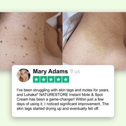 Luhaka® NATURESTORE Instant Mole & Spot Cream_Ultra01