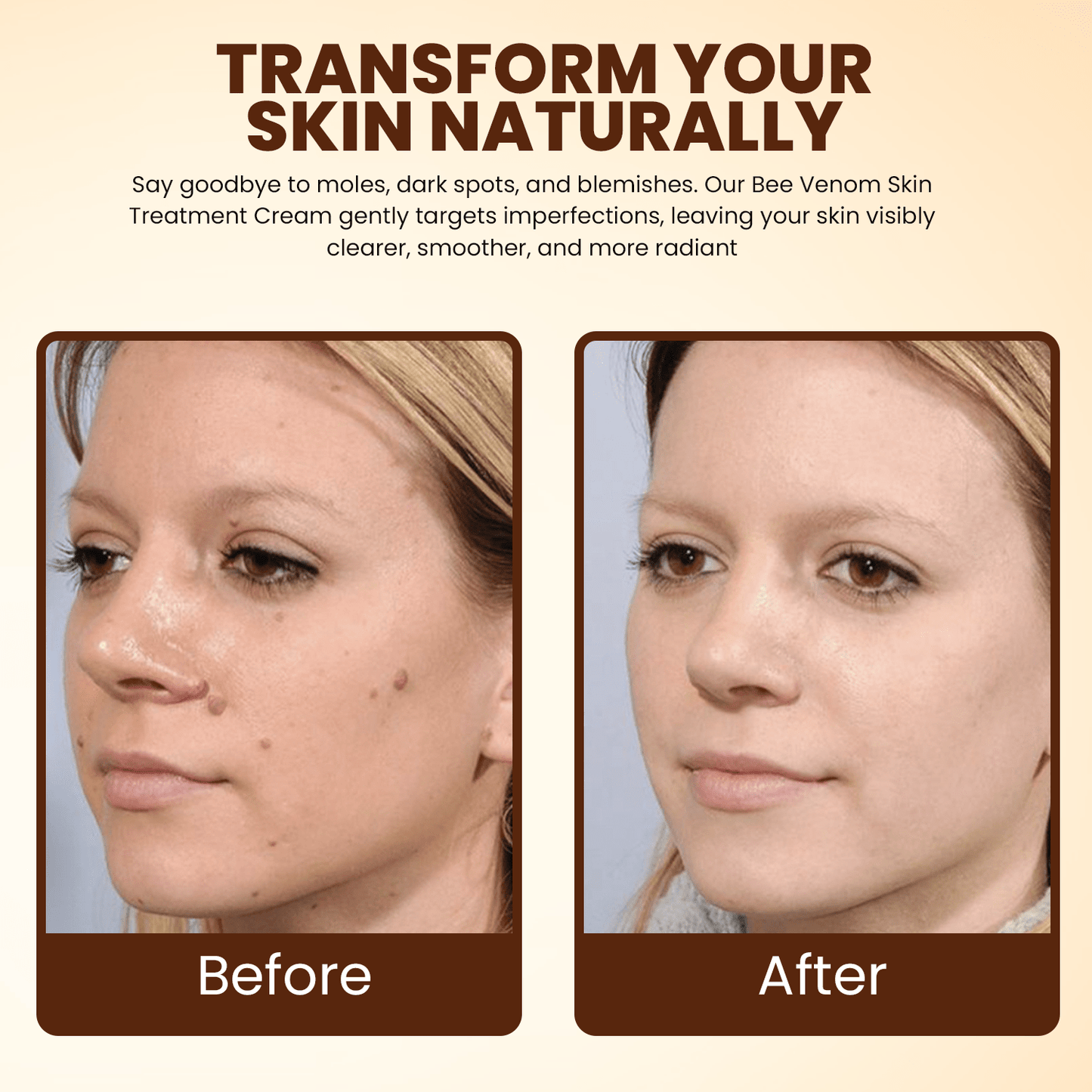 Lyyeto® Bee Venom Skin Treatment Cream