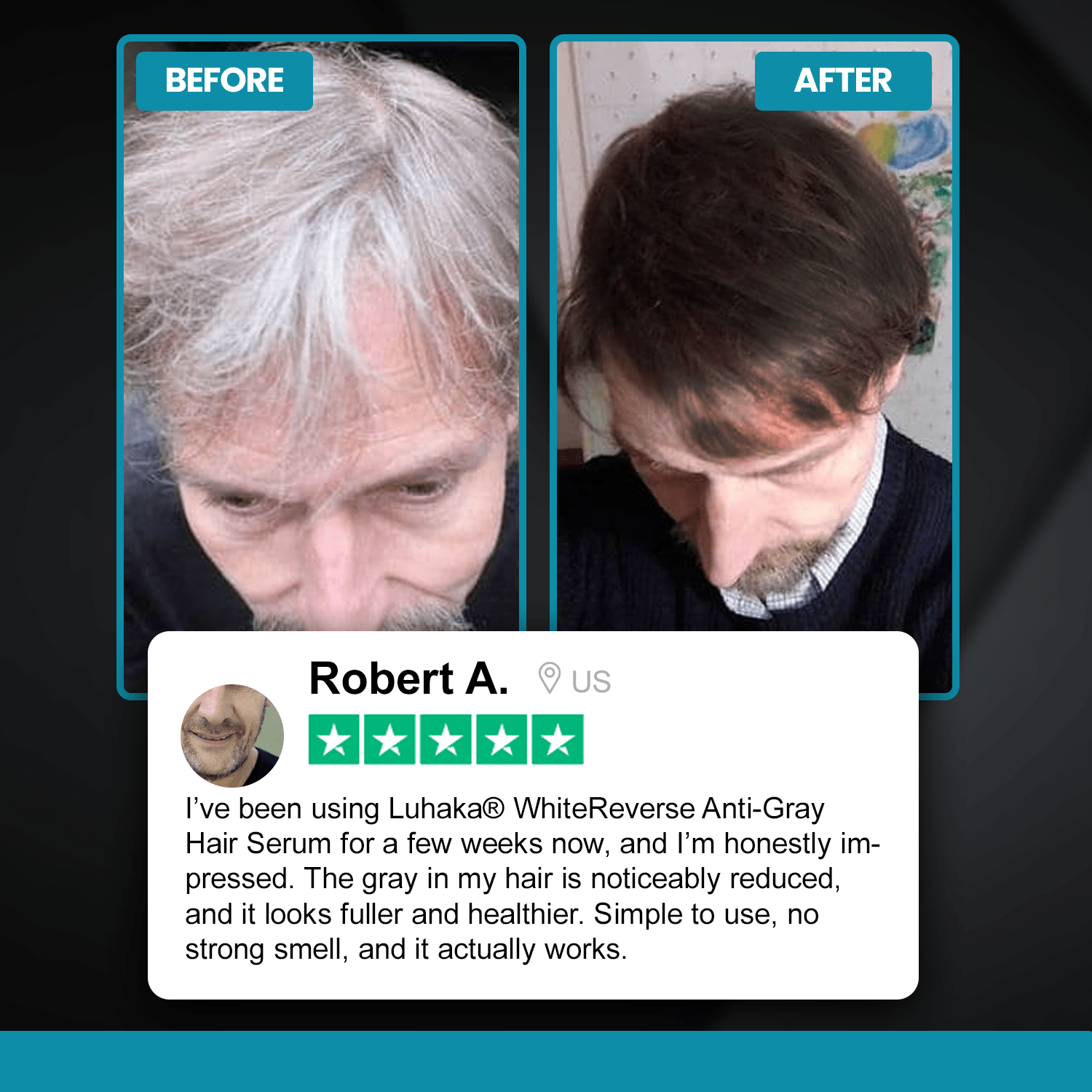Luhaka® WhiteReverse Anti-Gray Hair Serum