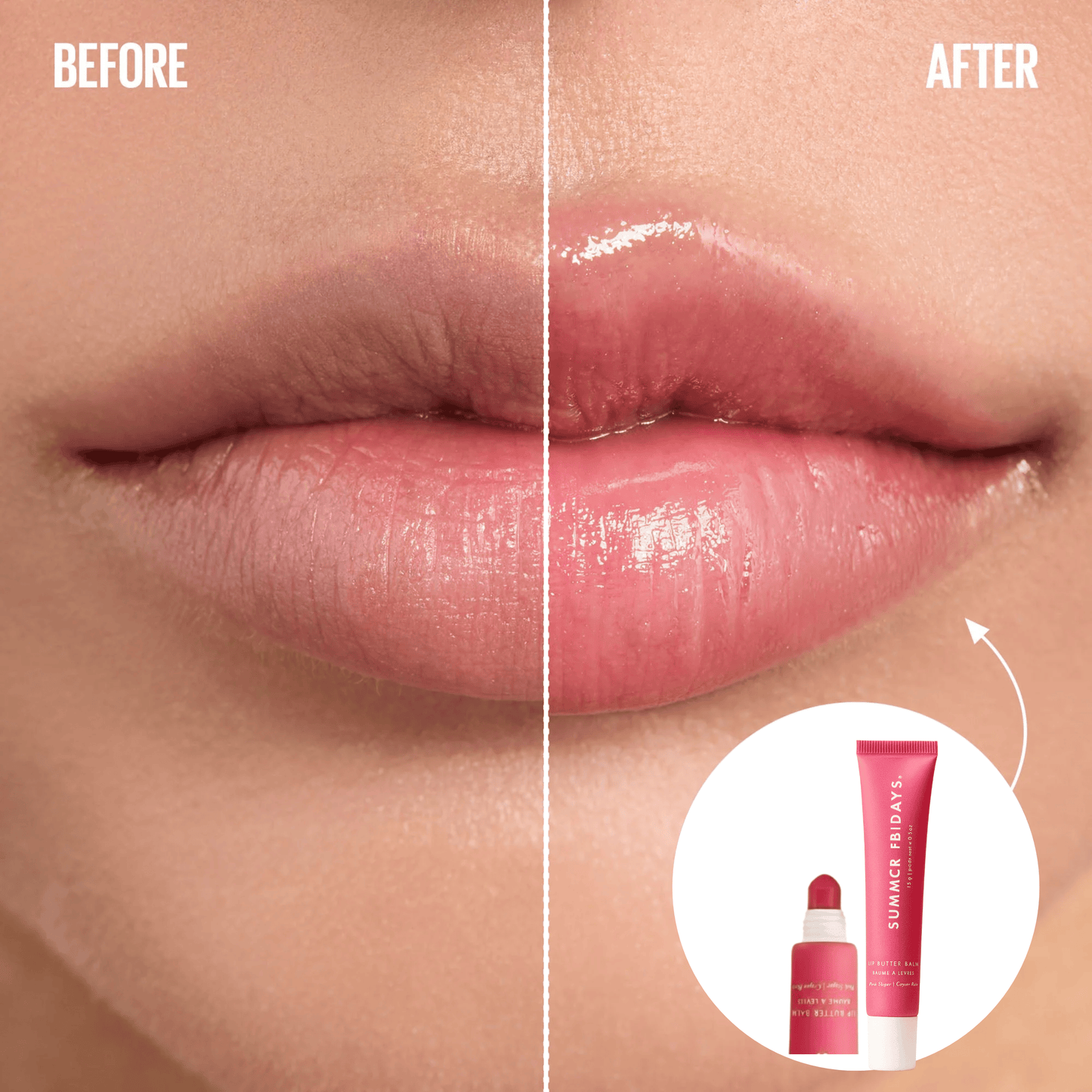 Summer Fruits Set | TikTok Exclusive