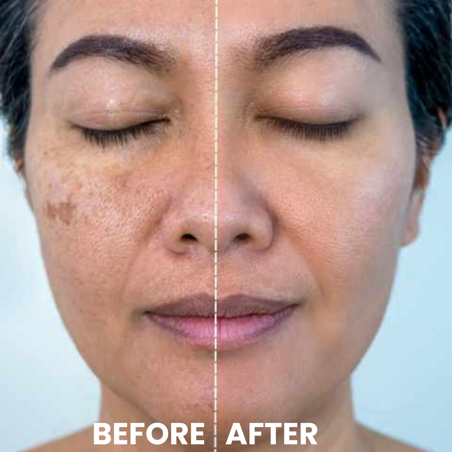 Luhaka® Ricerase Dual-Action Renewal Cream ACE 1