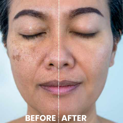 Luhaka® Ricerase Dual-Action Renewal Cream ACE 1