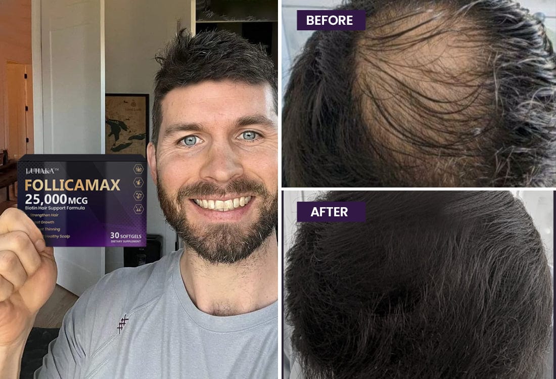 Luhaka™ FollicaMax 25,000 MCG Hair Growth Support 31 beforeandafter 1 2fdf606b 5b66 4b1e 938f a4d6f4e0737e