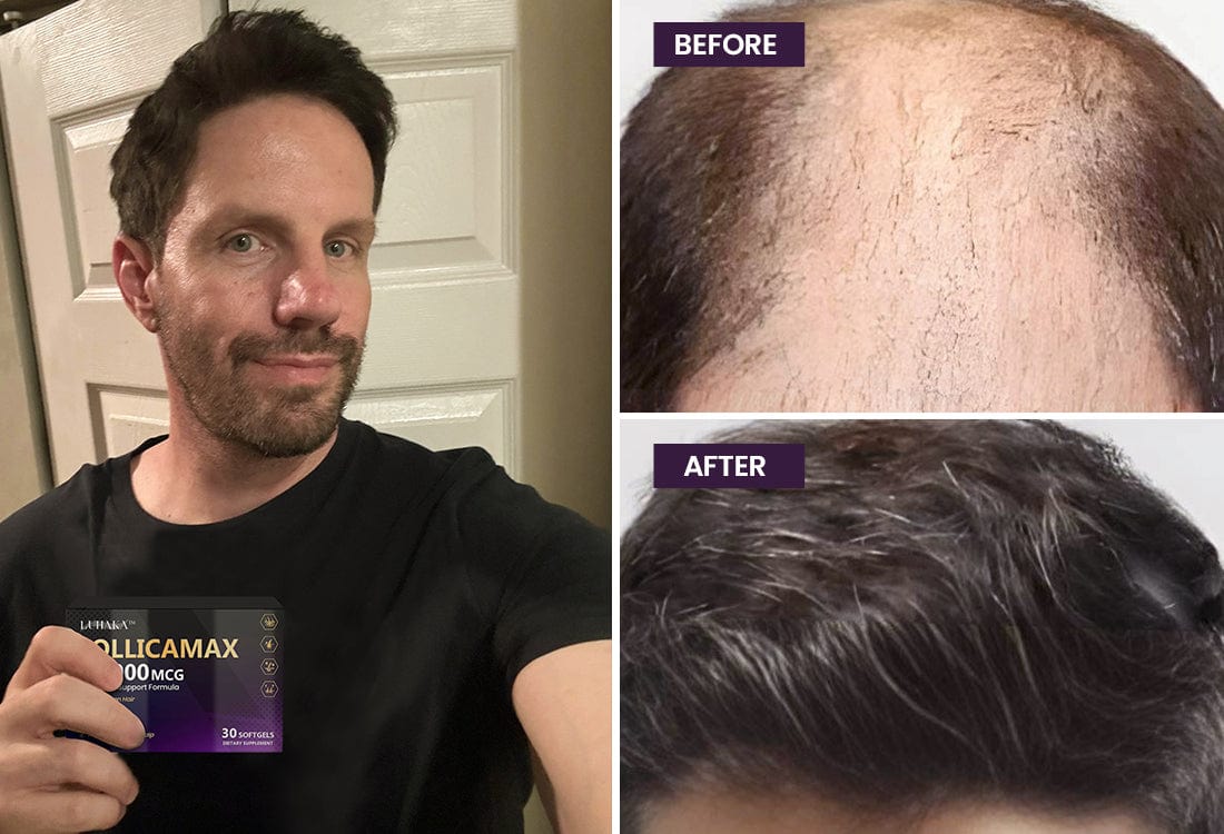 Luhaka™ FollicaMax 25,000 MCG Hair Growth Support 32 beforeandafter 3 e3d08643 12f2 4797 9b62 b0604f5cd419