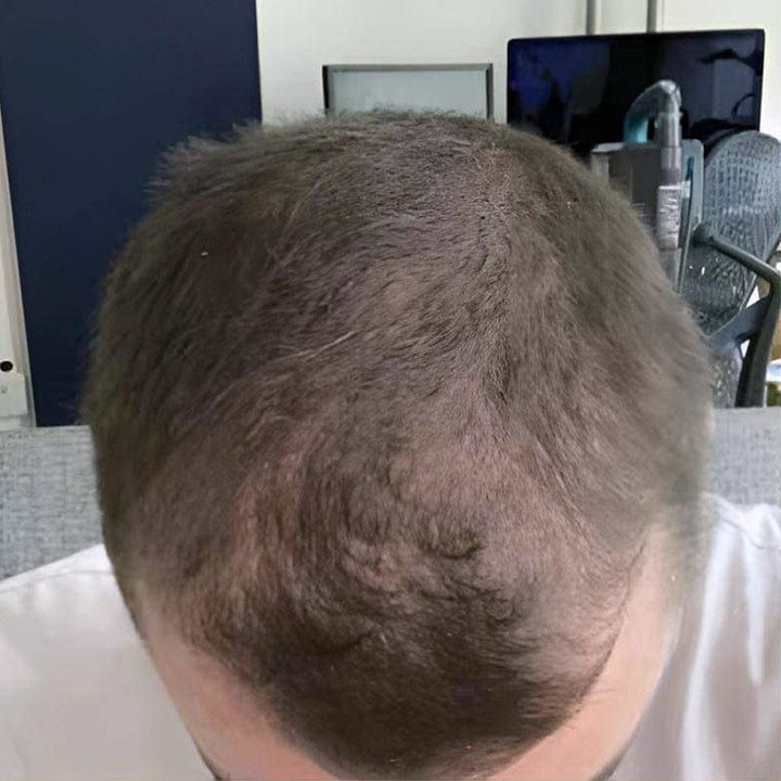 Luhaka™ FollicaMax 25,000 MCG Hair Growth Support 37 journey 2