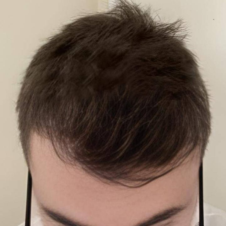 Luhaka™ FollicaMax 25,000 MCG Hair Growth Support 38 journey 3