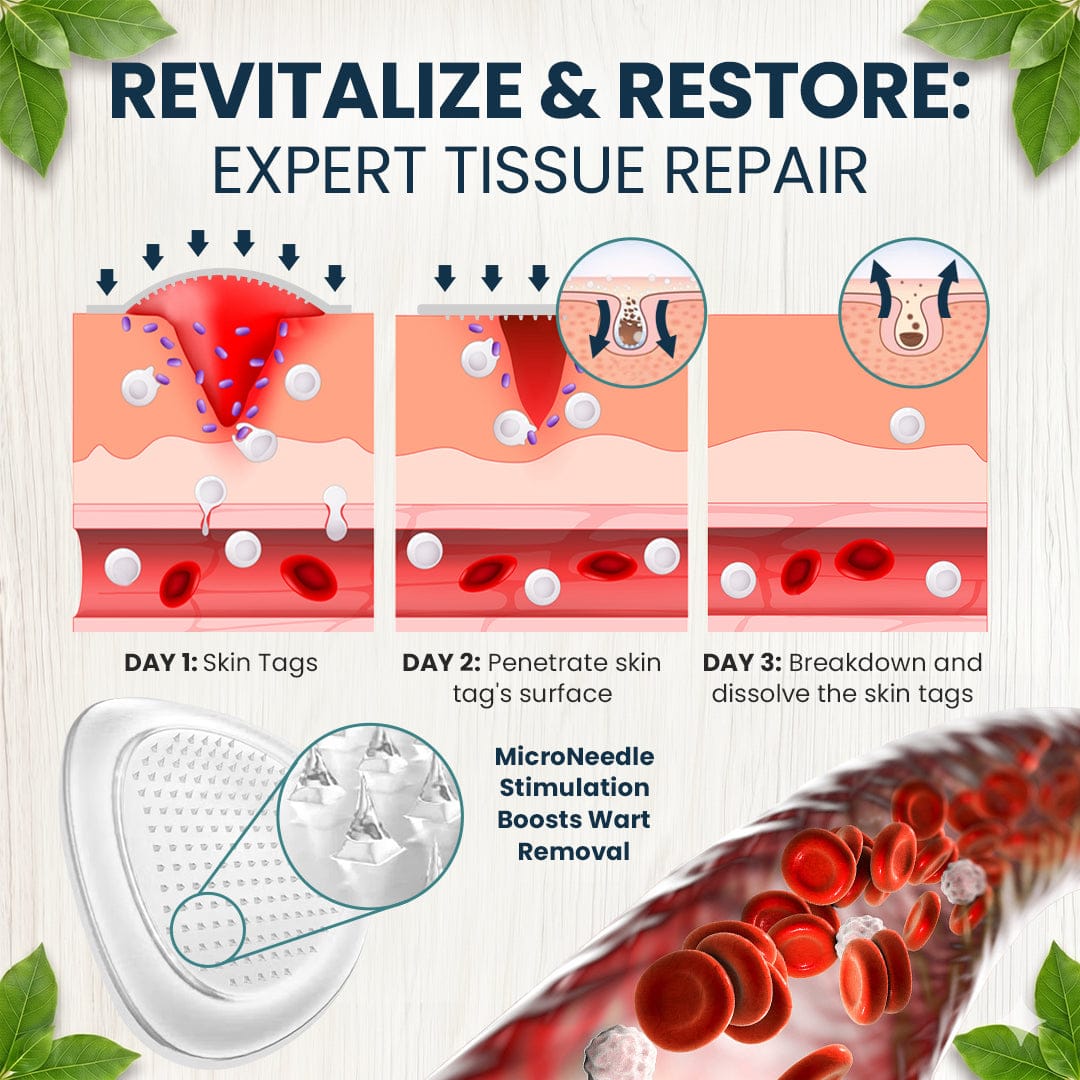 🌟 Luhaka® 2-in-1 Microneedle & Hydrocolloid Patch 🌿 A Dual-Action Solution for Face & Body Care—Helps Improve the Look of Moles, Acne, Flat Warts, Skin Tags, Wrinkles, Scars, and Other Common Skin Concerns ace 1