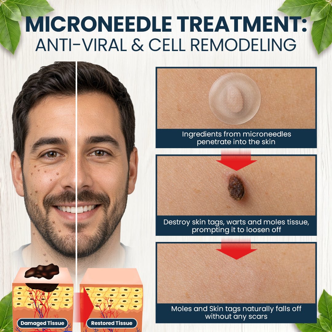 🌟 Luhaka® 2-in-1 Microneedle & Hydrocolloid Patch 🌿 A Dual-Action Solution for Face & Body Care—Helps Improve the Look of Moles, Acne, Flat Warts, Skin Tags, Wrinkles, Scars, and Other Common Skin Concerns ace 1